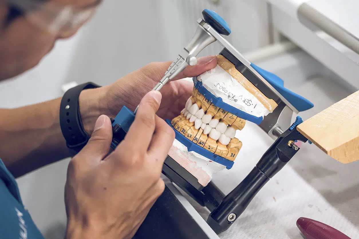 protesico-dental-que-es